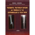 Tratamentul fracturilor diafizare ale femurului cu tijă centromedulară cu focar închis