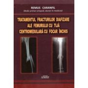 Tratamentul fracturilor diafizare ale femurului cu tijă centromedulară cu focar închis